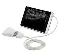 [E310-044822] Ultrassonografia Natus InVisus Pro